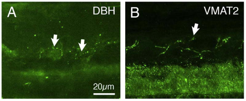 Fig. 18