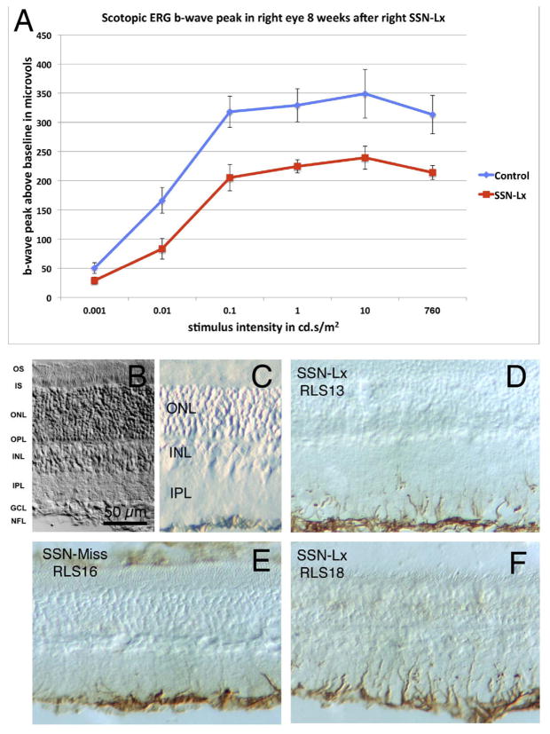 Fig. 14