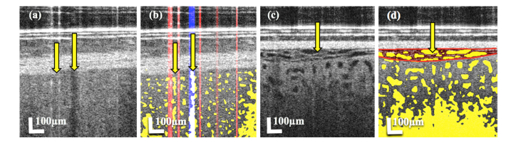 Fig. 12