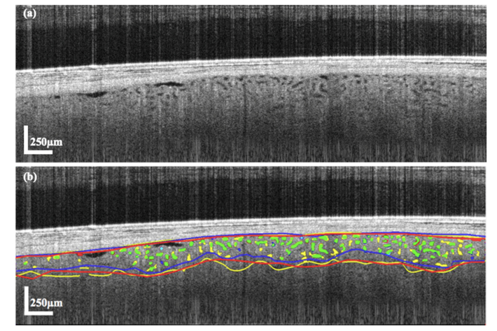 Fig. 15