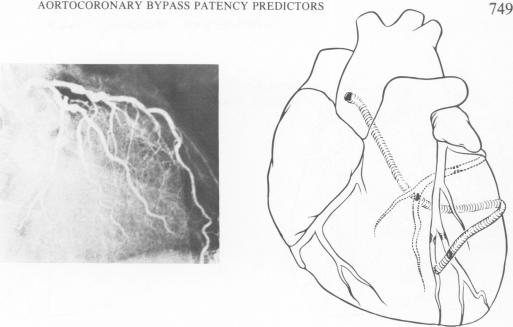 Fig. 12.