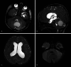 FIG. 2.