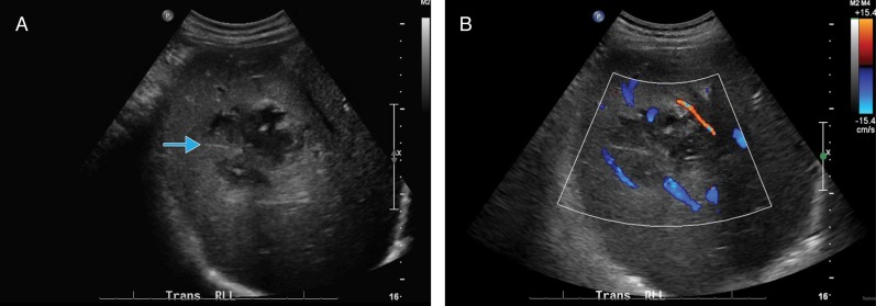 Fig. 3.