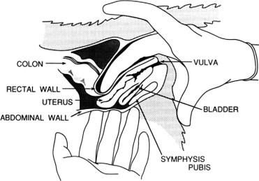 FIGURE 8.2