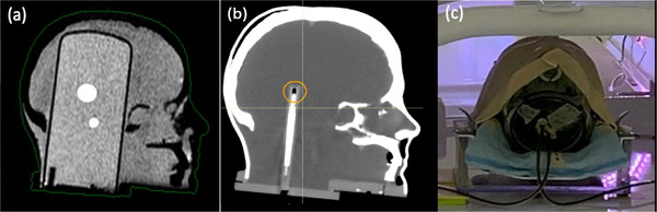 FIGURE 1