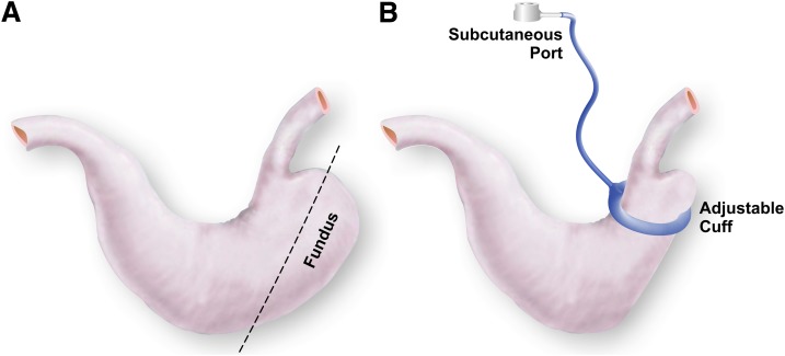 FIG. 1.