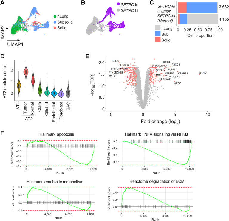 Figure 4. Deregulation of AT2 cells in subsolid nodules. A, AT2 cells from sub- and solid nodules cluster separately from AT2 cells from matching nLung. Colors represent nodule types. B, Two major AT2 clusters identified on the basis of high (hi) or low (lo) SFTPC expression. C, Proportions of SFTPC-high and -low cells obtained from nodules and nLung. Values indicate cell numbers in the respective groups. Colors indicate tissue types. D, Violin plots of module scores representing AT2 lineage marker expression in various nonimmune cell populations. E, Volcano plot representing DEGs between nodule- and nLung-derived AT2 cells. P values (y-axis) and fold changes (x-axis) were calculated by the edgeR approach. The red dots indicate DEGs identified by both edgeR and MAST approaches. F, GSEA plots of the top deregulated pathways in AT2 cells from subsolid/solid nodules compared with nLung.