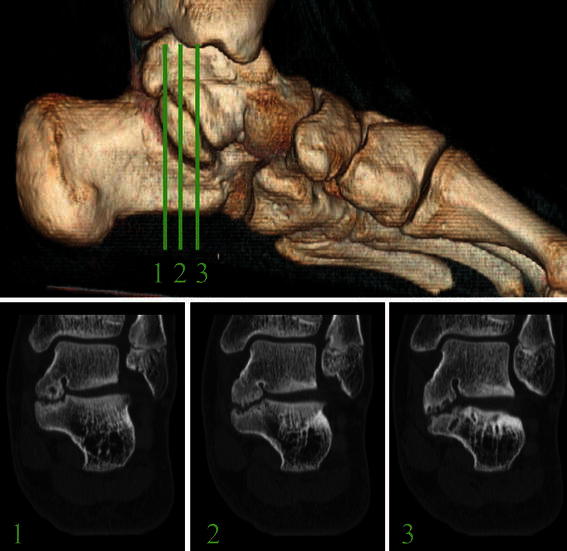 Fig. 3