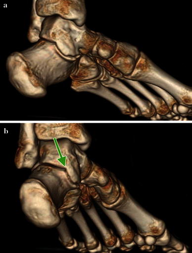 Fig. 5