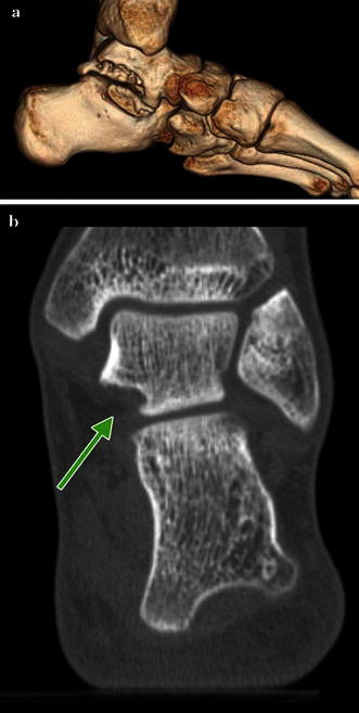 Fig. 11