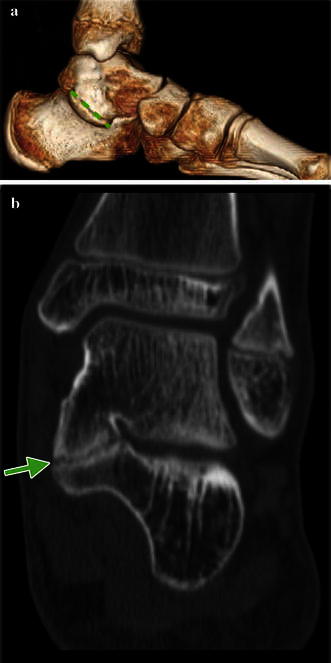 Fig. 8