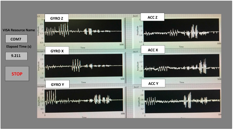 Figure 3