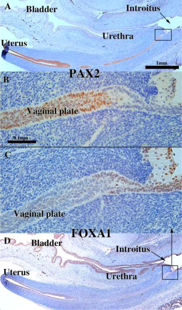 Figure 17