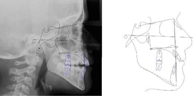 Figure 13