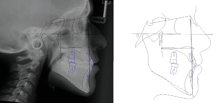 Figure 15