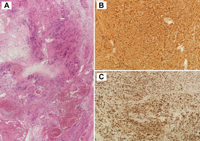 Figure 2