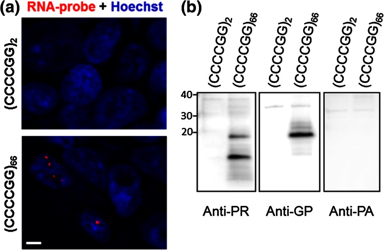 Antisense transcripts of the expanded C9ORF72 hexanucleotide repeat ...
