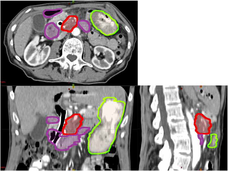 Figure 1: