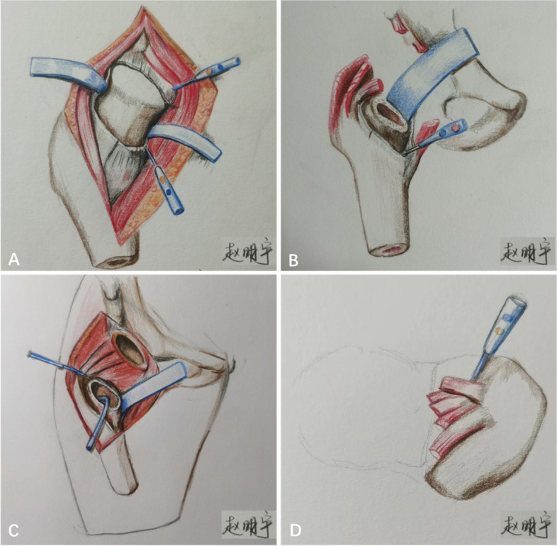 Fig. 3