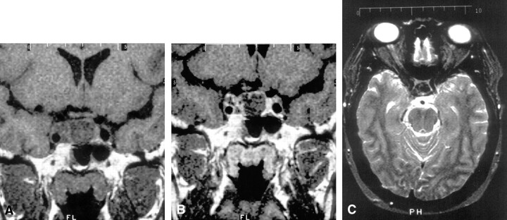 Fig 1.