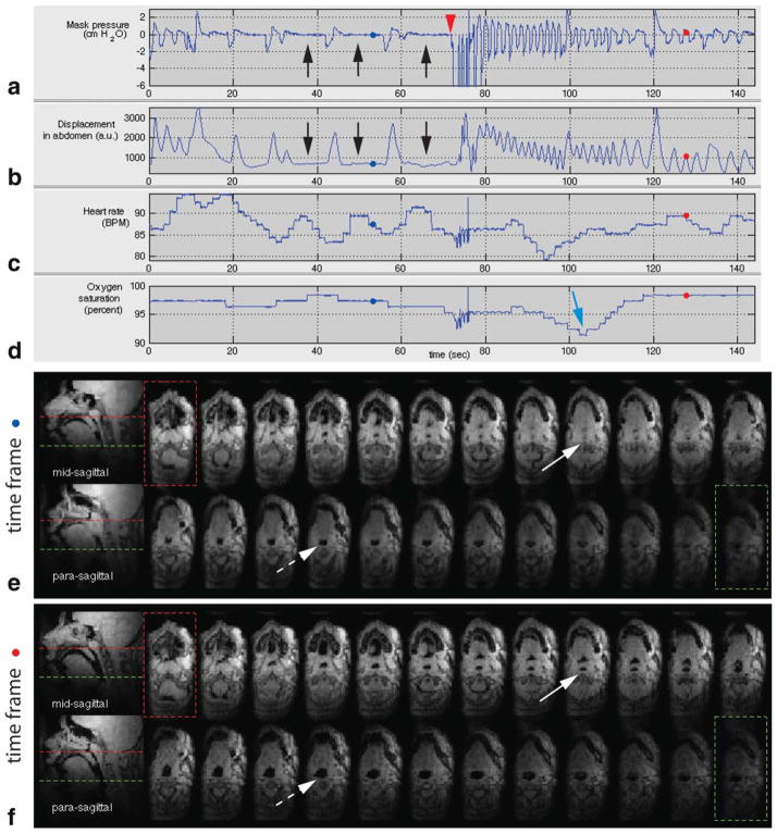 FIG. 7