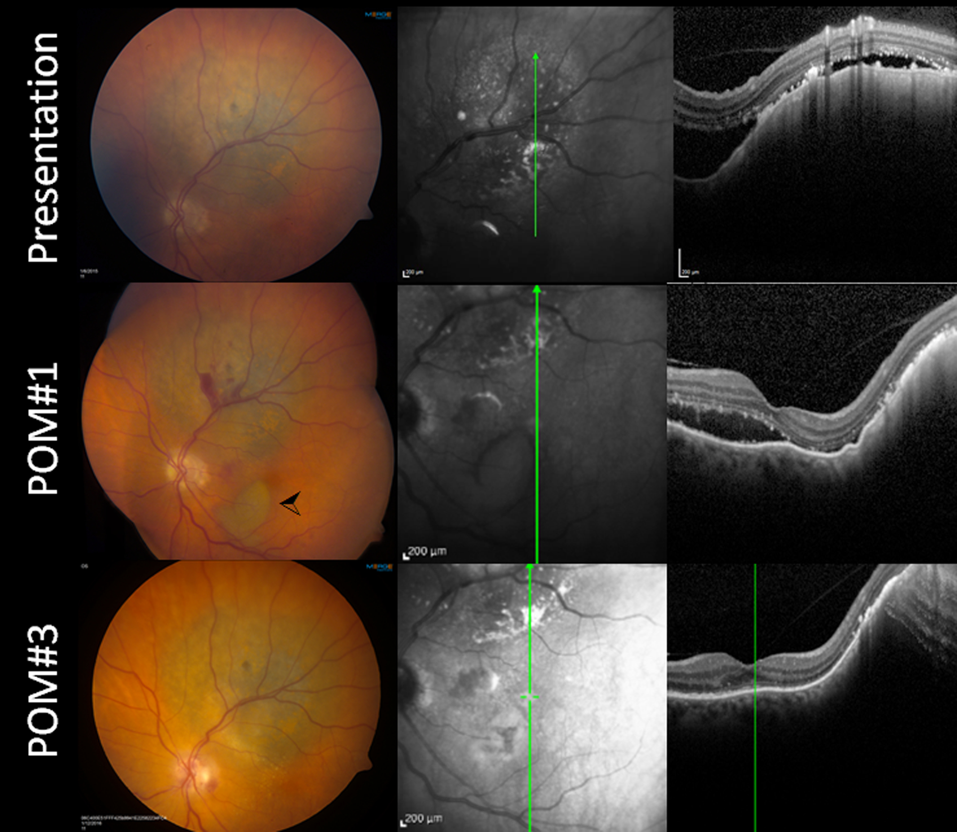 Figure 3: