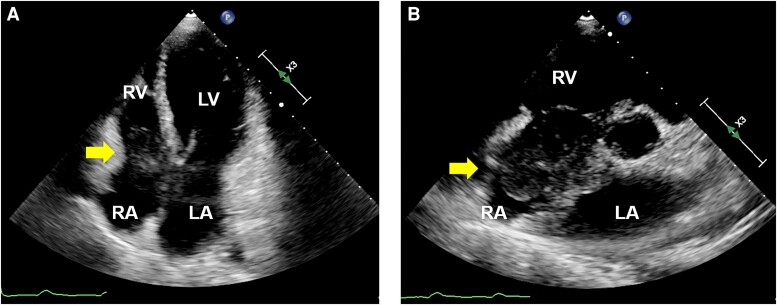 Figure 2