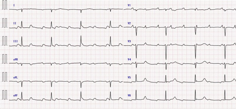 Figure 1