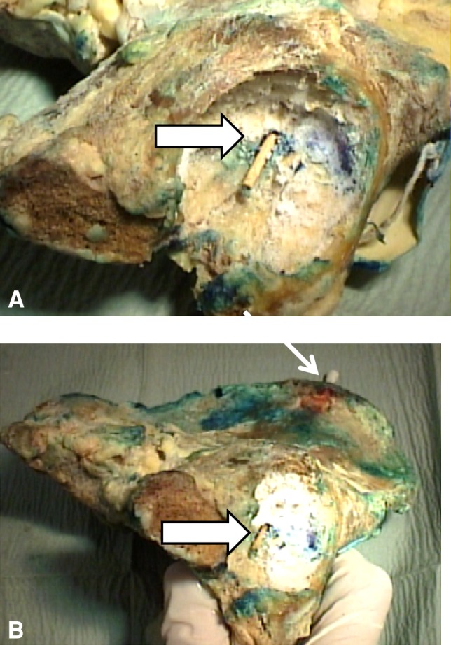 Fig. 2A–B