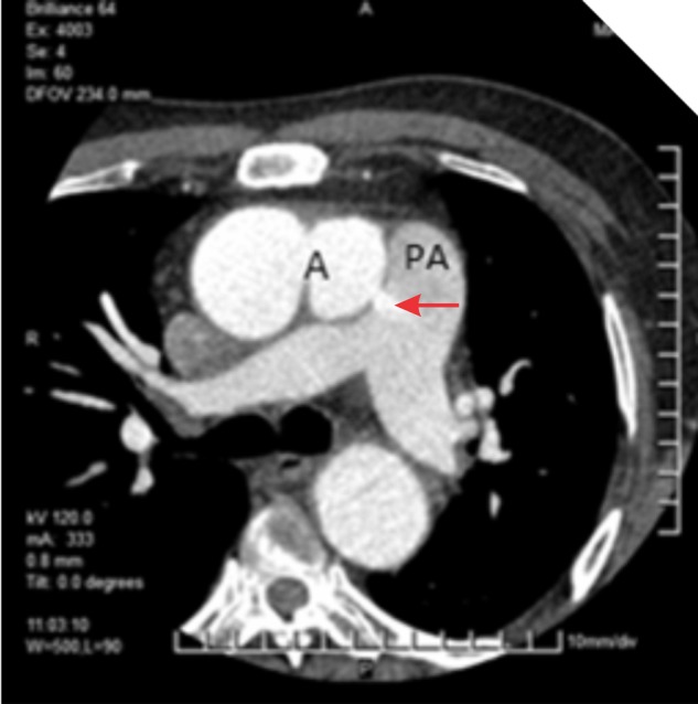 Figure 3