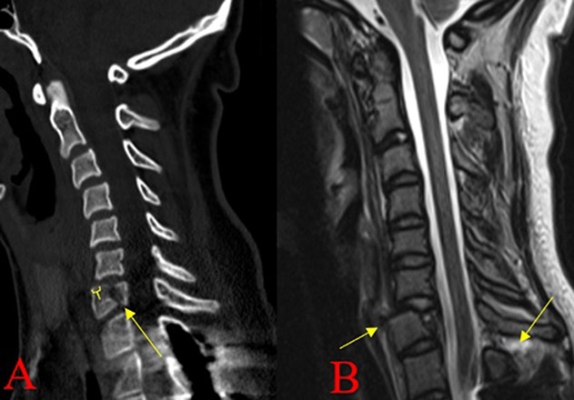 Fig. 4 A-B