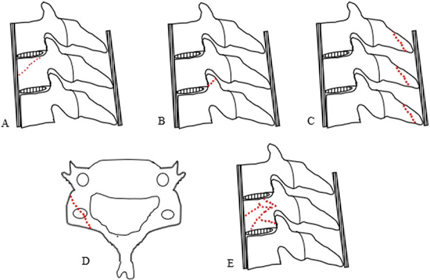 Fig. 1 A-E