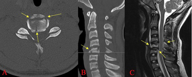 Fig. 6 A-C