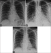 Figure 1 (A-C)