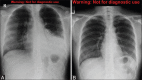 Figure 4 (A and B)