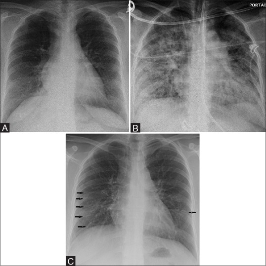 Figure 2 (A-C)