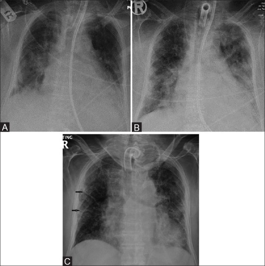 Figure 3 (A-C)