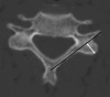 Fig. 2
