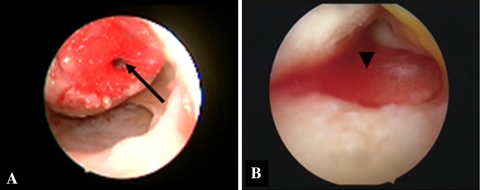 Fig. 1A–B