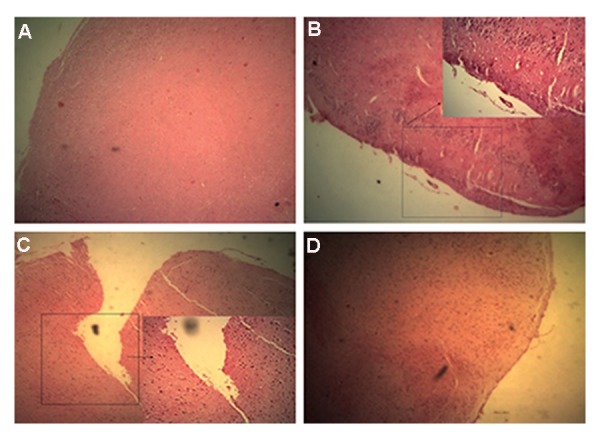 Fig.11