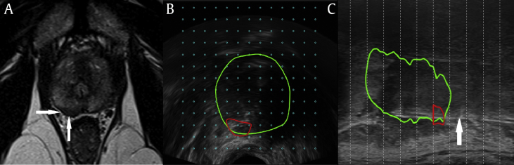 Fig. 1