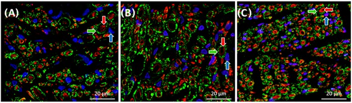 Figure 11