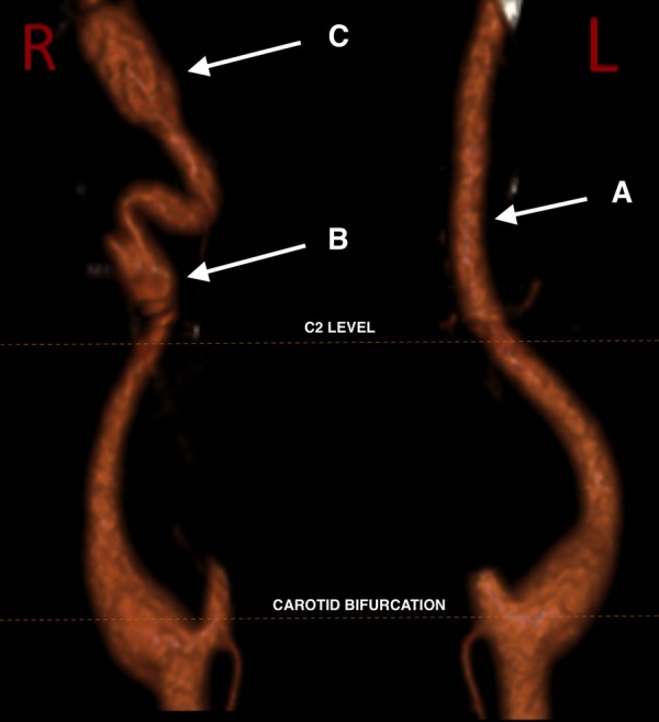 Figure 3