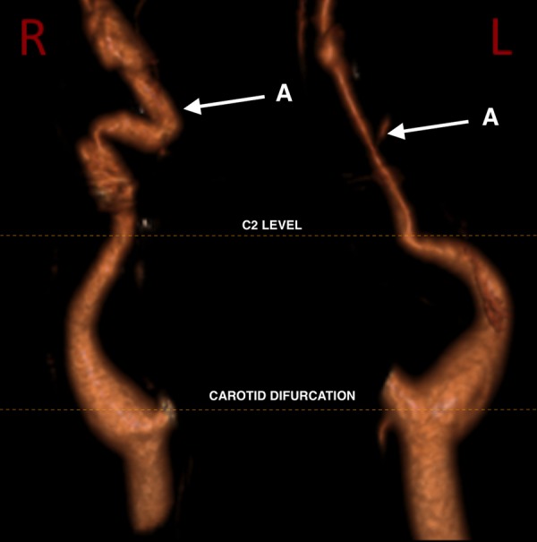 Figure 2