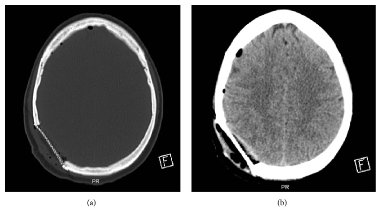 Figure 6