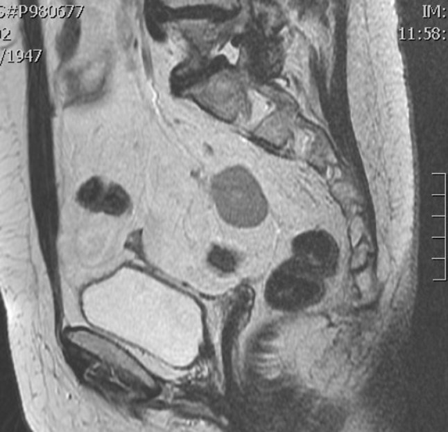 Fig. 2