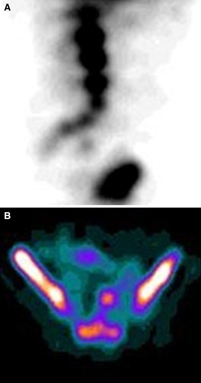 Fig. 4