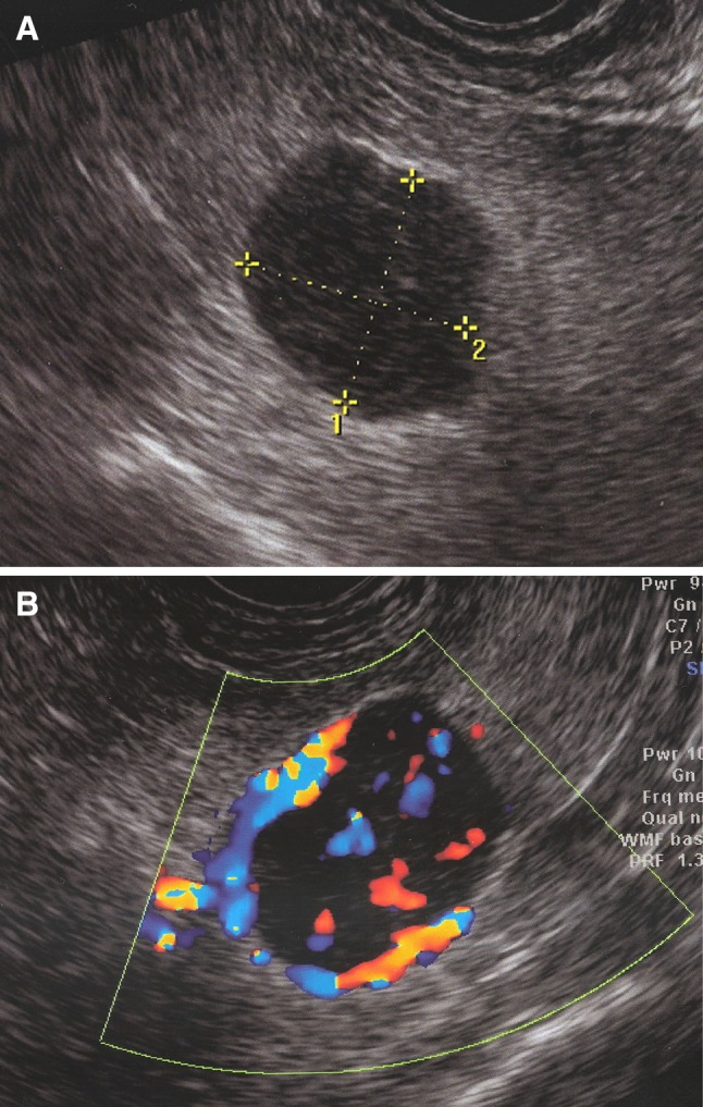 Fig. 1
