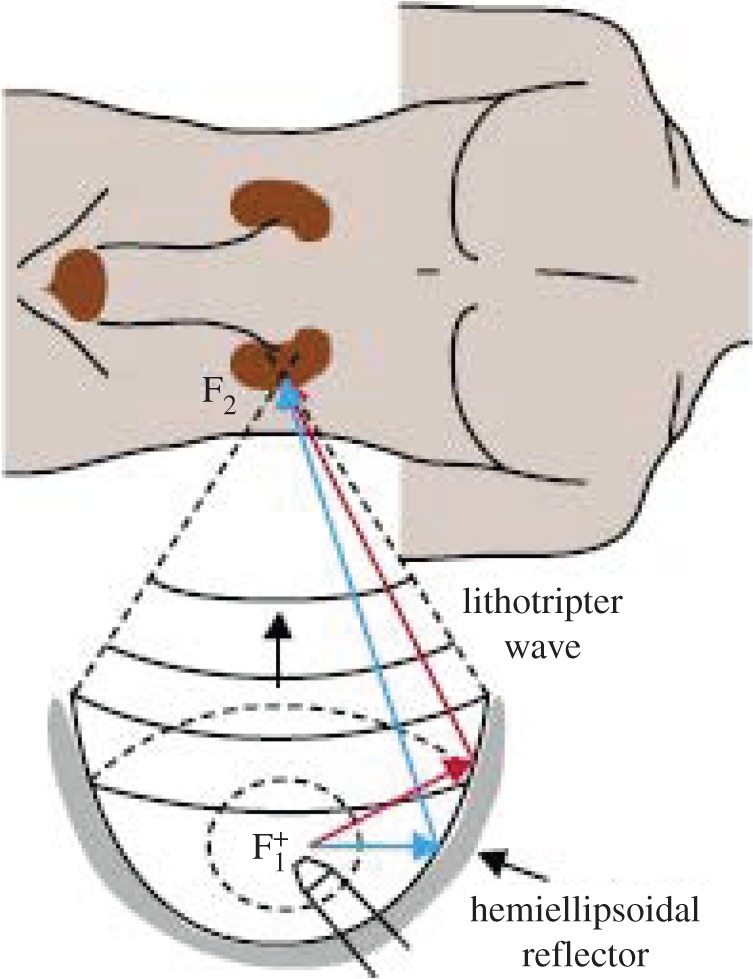 Figure 18.