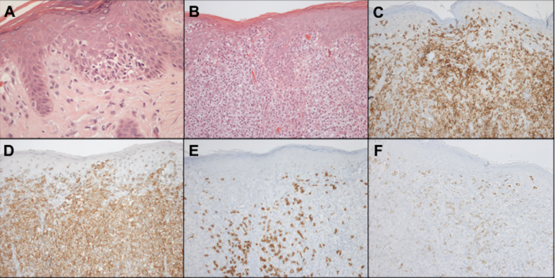 Figure 11